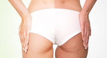 getting-rid-of-thigh-fat