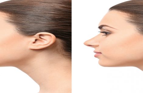 all-you-need-to-know-about-rhinoplasty